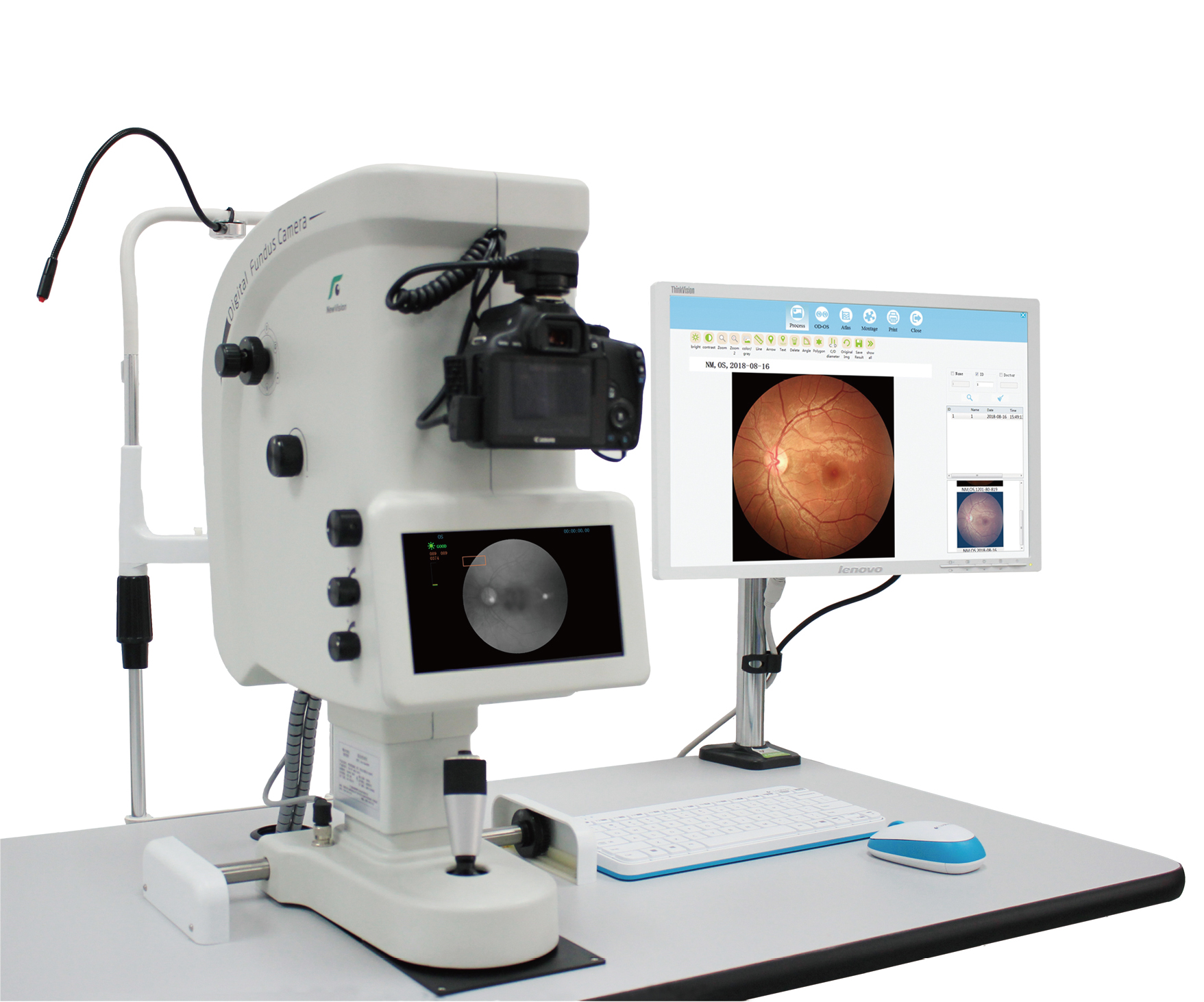 Reticam 3000 PLUS Non-mydriatic Automatic Fundus Camera